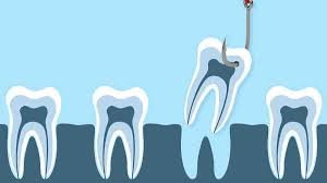 ¿Te has visto afectado@ por el cierre de Dentix?